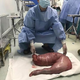 El megacolon de Hai. Imagen: AsiaWire